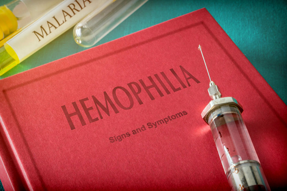 Factors That can Raise the Risk of Hemophilia